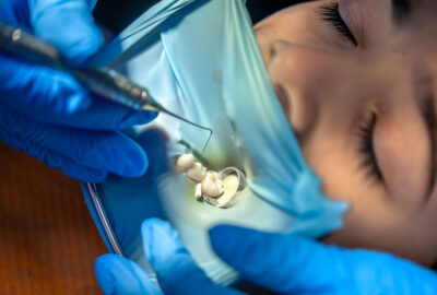 Biomatéiaux dentisterie Ivrydent