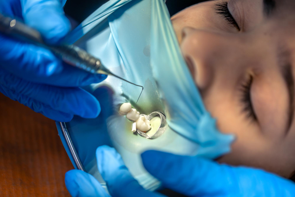 Biomatéiaux dentisterie Ivrydent