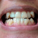 Médicaments et santé dentaire