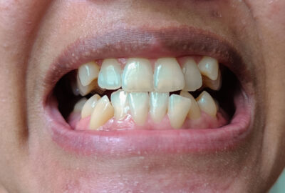 Médicaments et santé dentaire