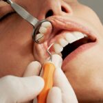 Chirurgie orale : interventions, préparation et suivi post-opératoire