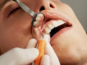Chirurgie orale : interventions, préparation et suivi post-opératoire