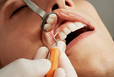Chirurgie orale : interventions, préparation et suivi post-opératoire